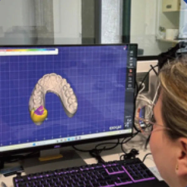 CEREC<br>Diseño digital